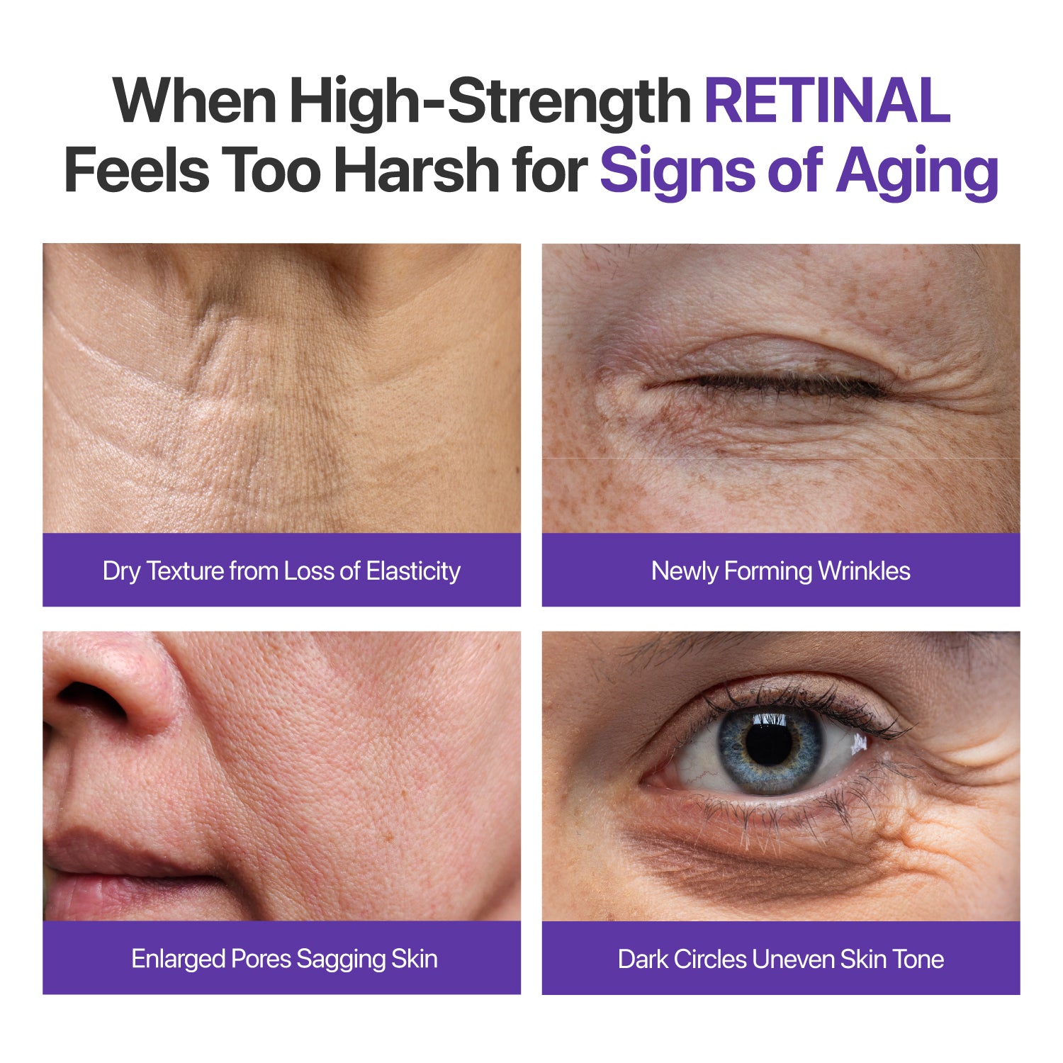 Gentle enough for full face use on smile lines forehead creases and fine lines