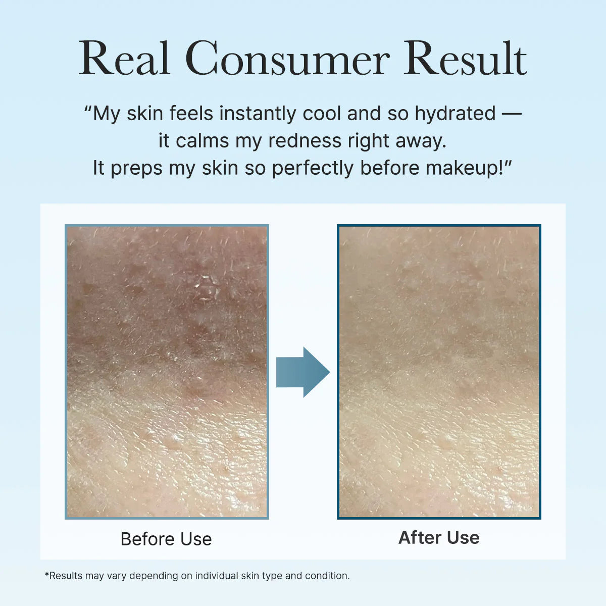 Arencia PDRN Hyaluronic Deep Hydration Pad