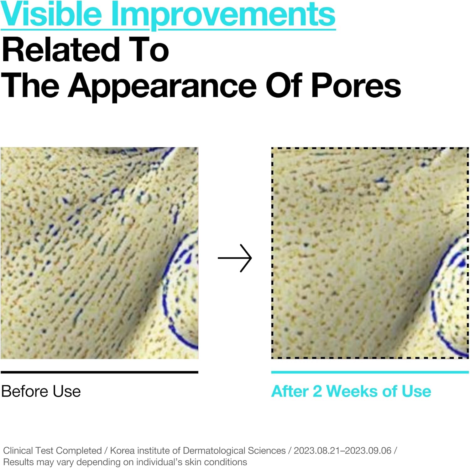 ANUA BHA 2% Gentle Exfoliating Toner