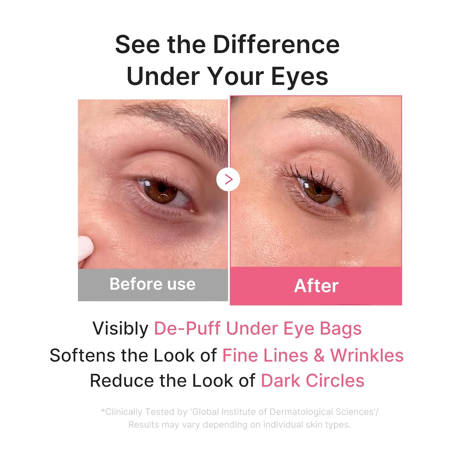 Targets puffiness dark circles dryness uneven tone and fine lines around eyes