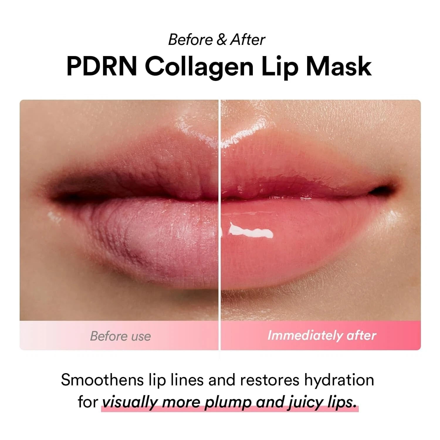PDRN collagen lip treatment for smoother elastic-looking lips