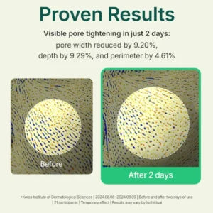 Centellian24 Madeca Powder Teatree AC