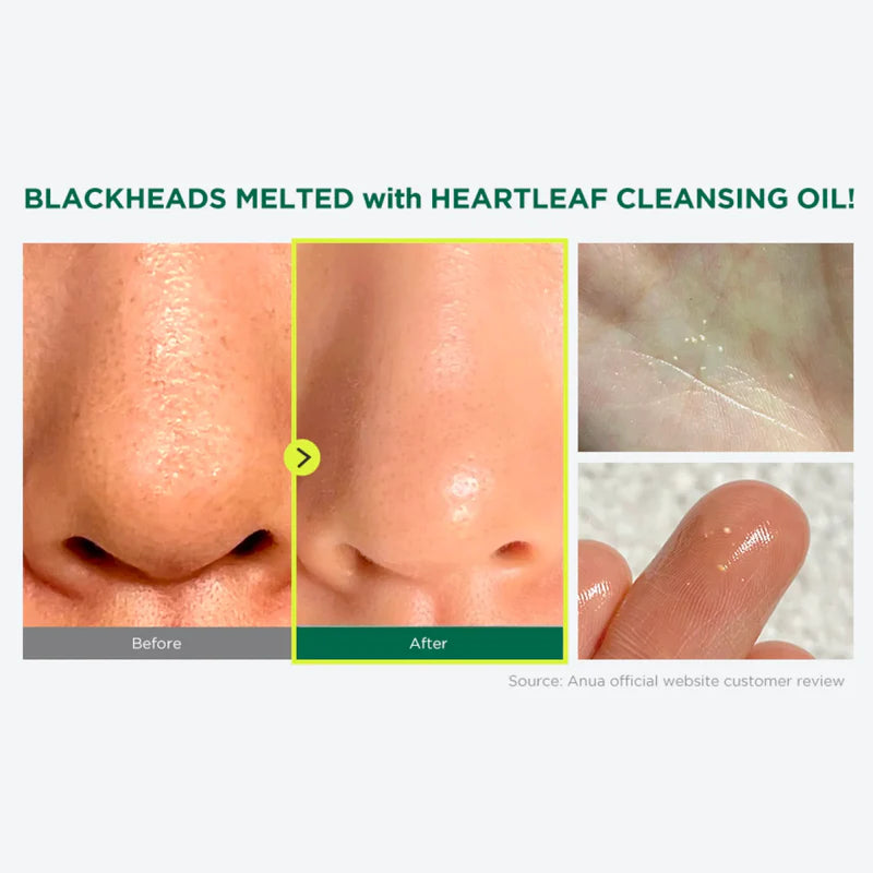 ANUA Heartleaf Pore Control Cleansing Oil Mini