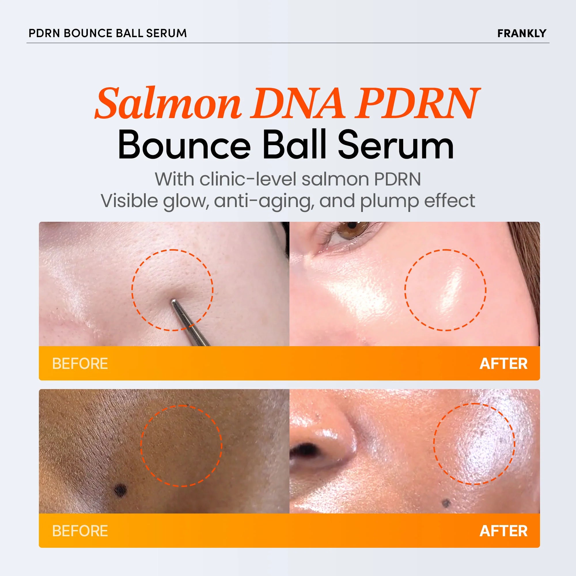 FRANKLY Salmon PDRN Bounce Ball Serum