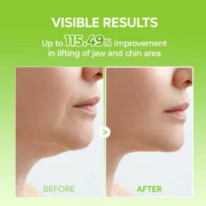 Dr.Melaxin CACTOX V-Lifting Mewing Band
