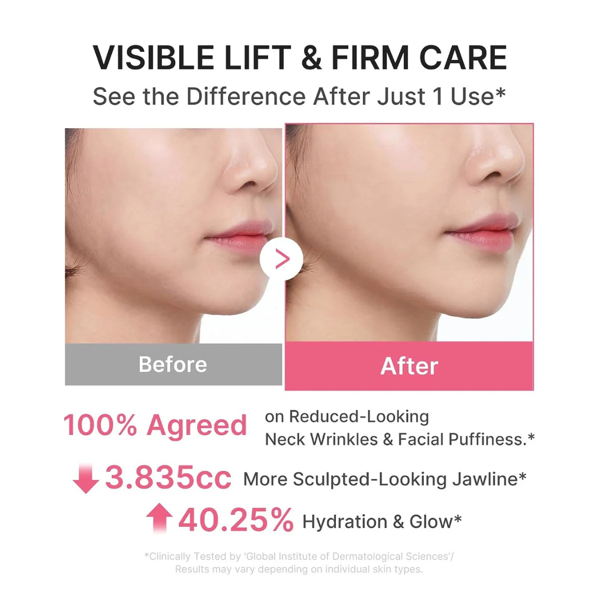Salmon PDRN and Collagen visibly lift firm and smooth horizontal tech neck lines