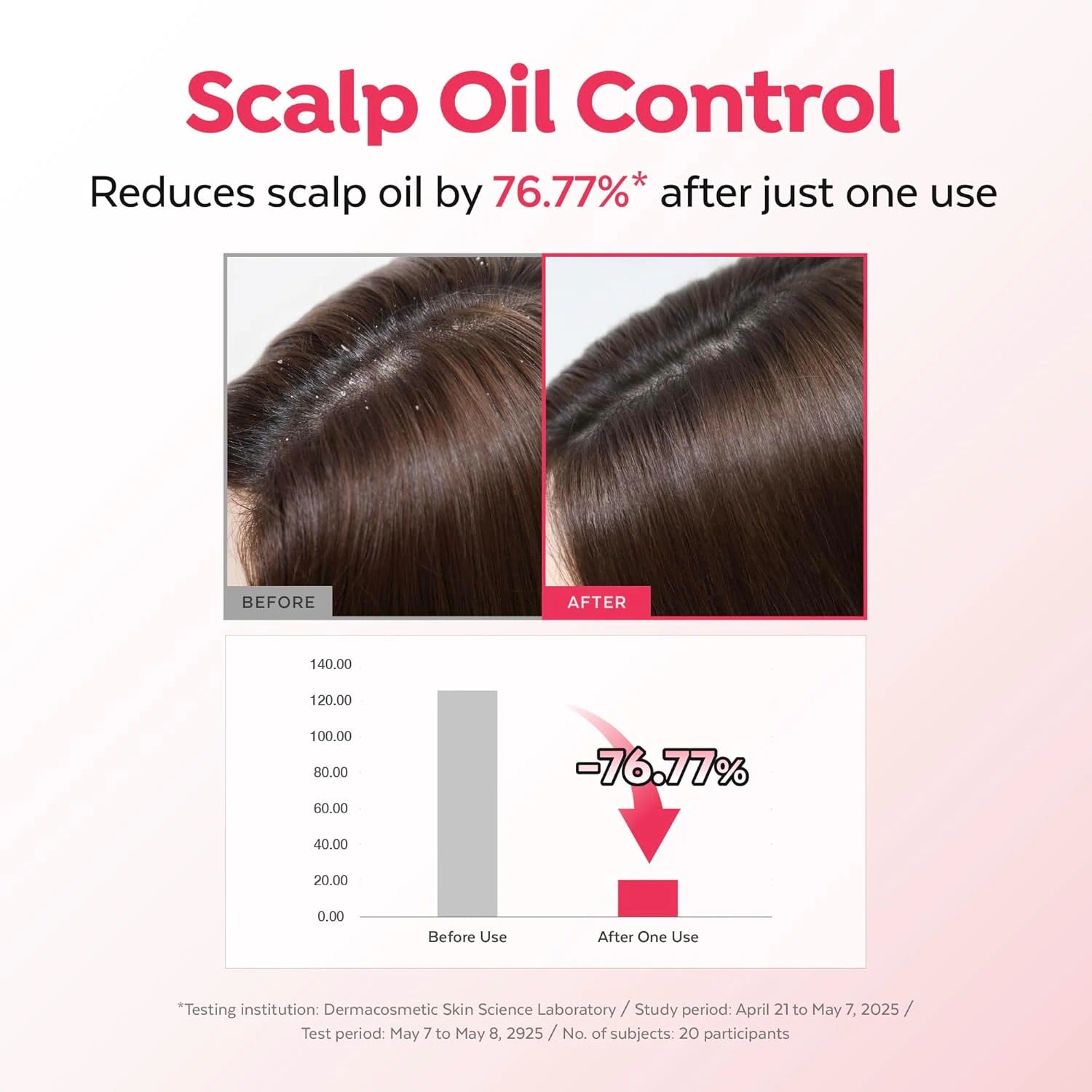Advertisement for scalp oil control product showing before and after effects on hair with a bar graph indicating reduction.