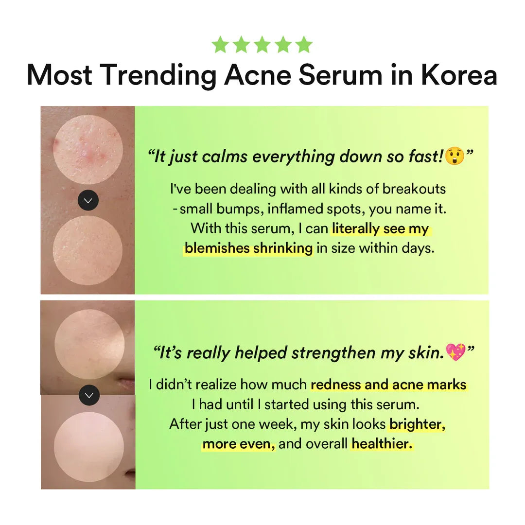 Abib Heartleaf TECA Capsule Serum Calming Drop – 50ml / 1.69 fl.oz Airless Pump Bottle