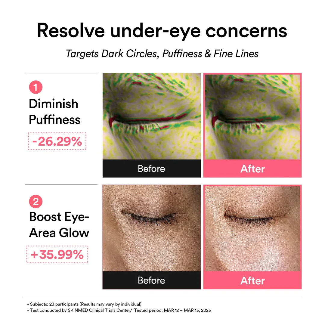 Abib PDRN Retinal Eye Patch Glow Jelly – Retinal Anti-Wrinkle Care for the Eye Area