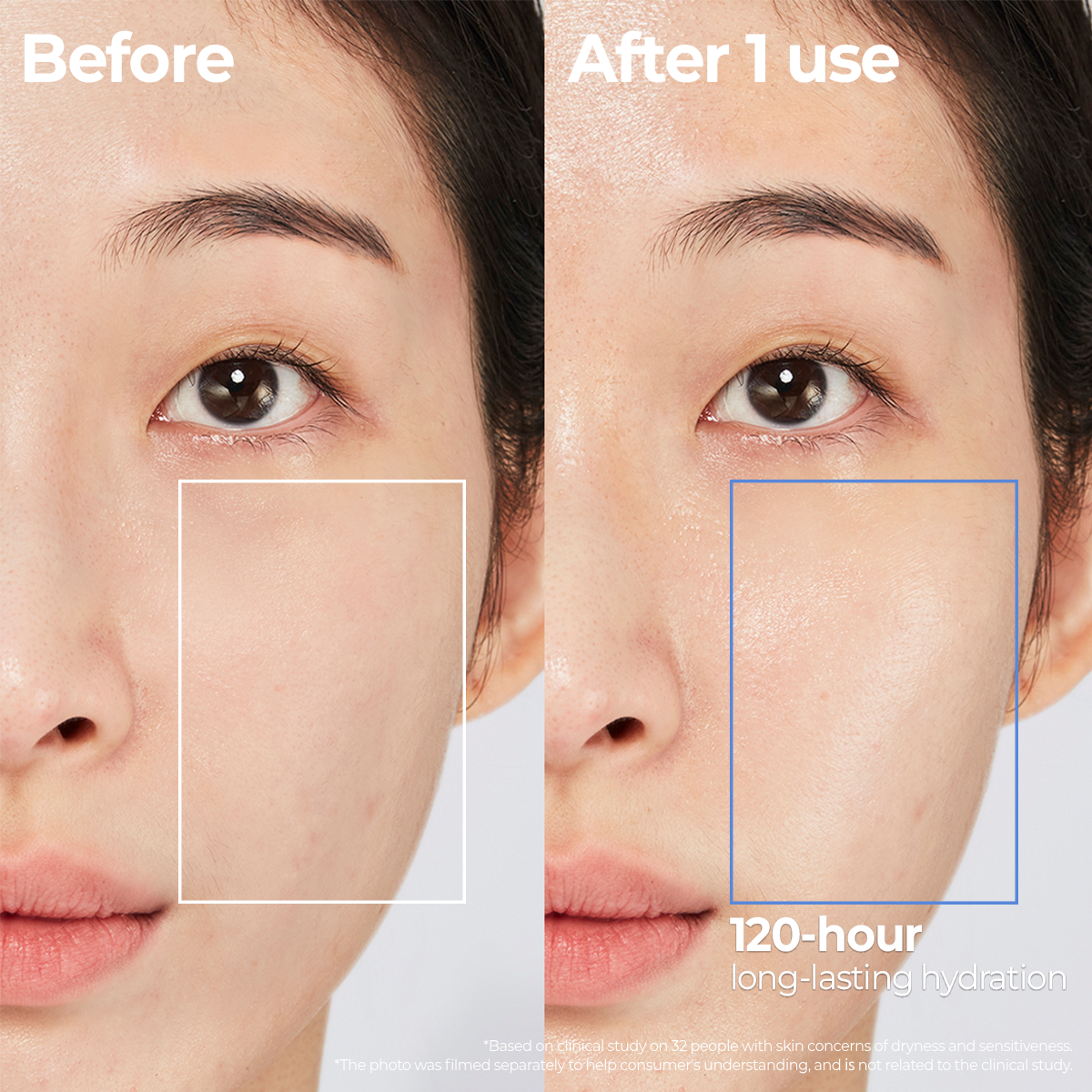 AESTURA Atobarrier 365 Cream – before and after results