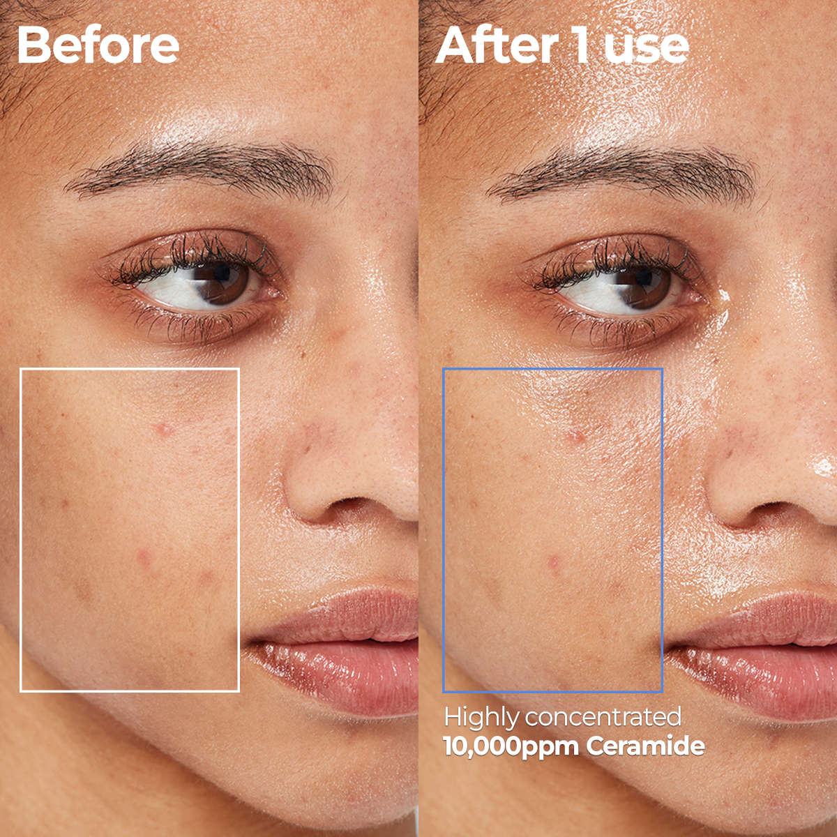 AESTURA Atobarrier 365 Cream Mist – before and after results