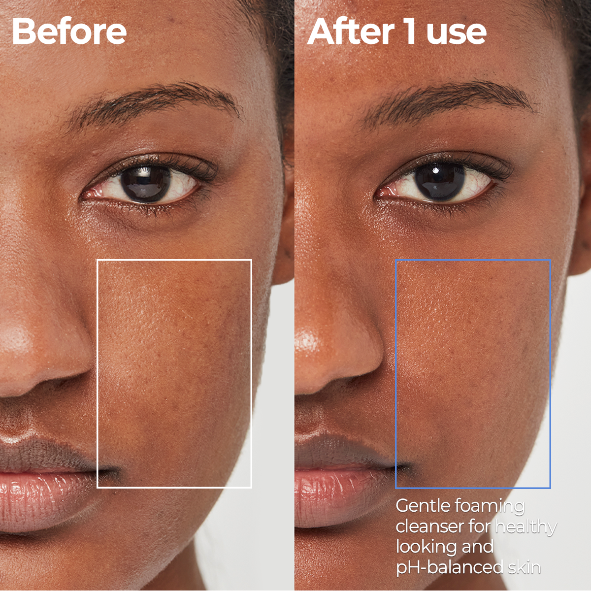 AESTURA Atobarrier 365 Foaming Cleanser – before and after results