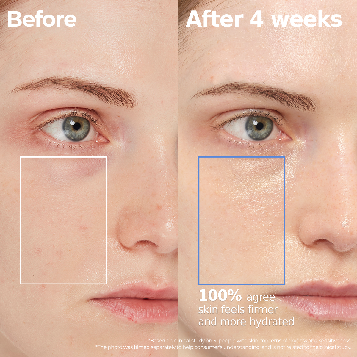AESTURA Atobarrier 365 Hydro Cera-Ha Serum – before and after results