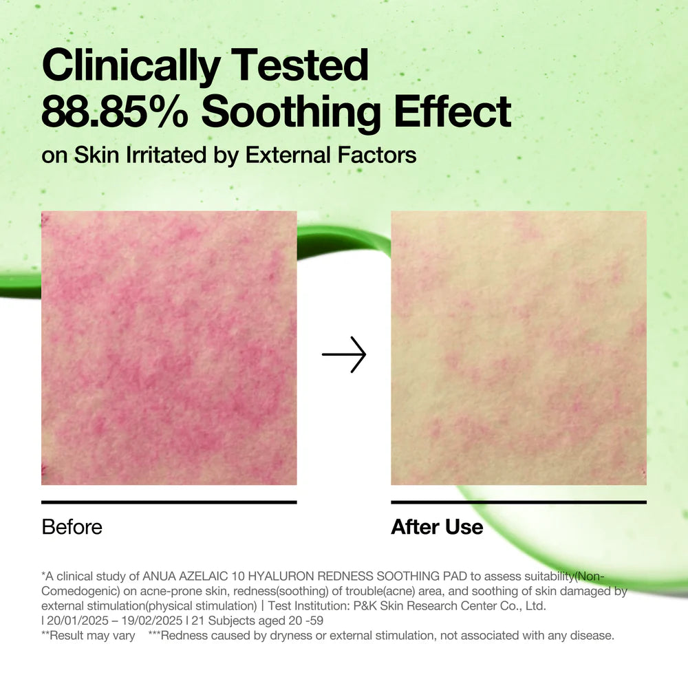 ANUA Azelaic Acid 10 Hyaluron Redness Soothing Pad — soothes visible redness for a calmer complexion
