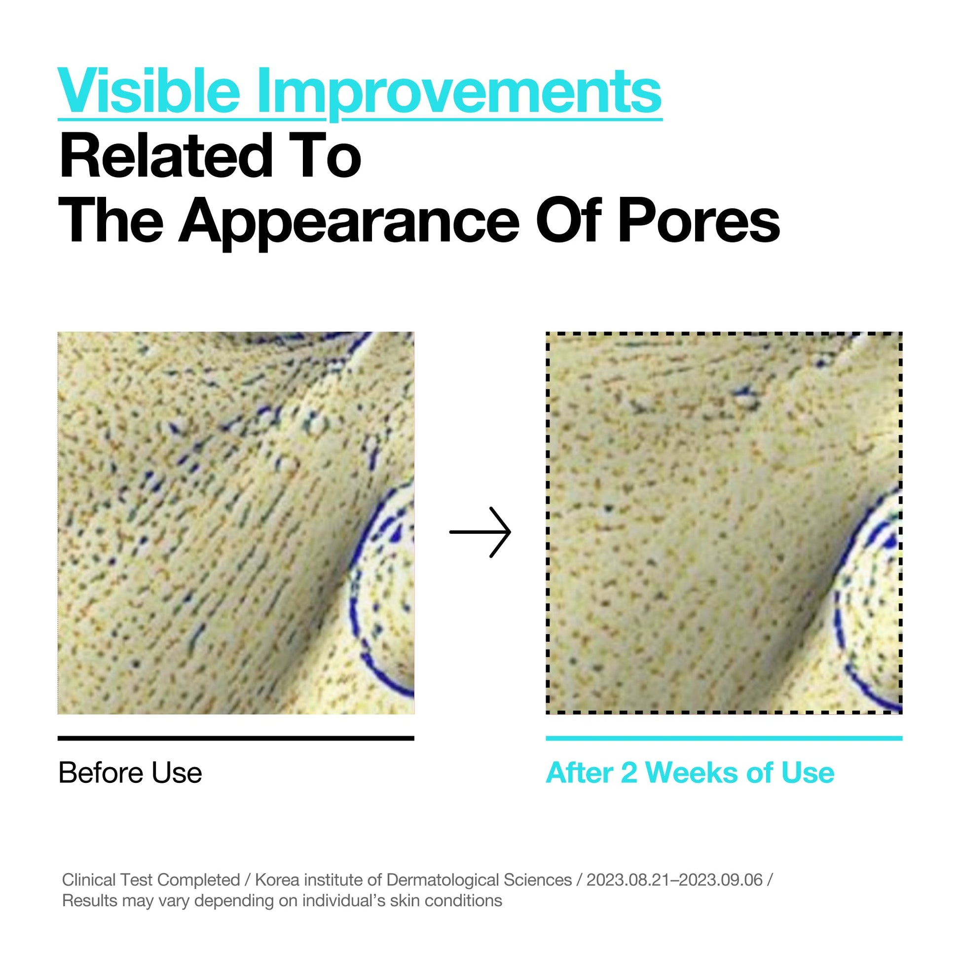 Fragrance-free, low-irritation formula for sensitive skin