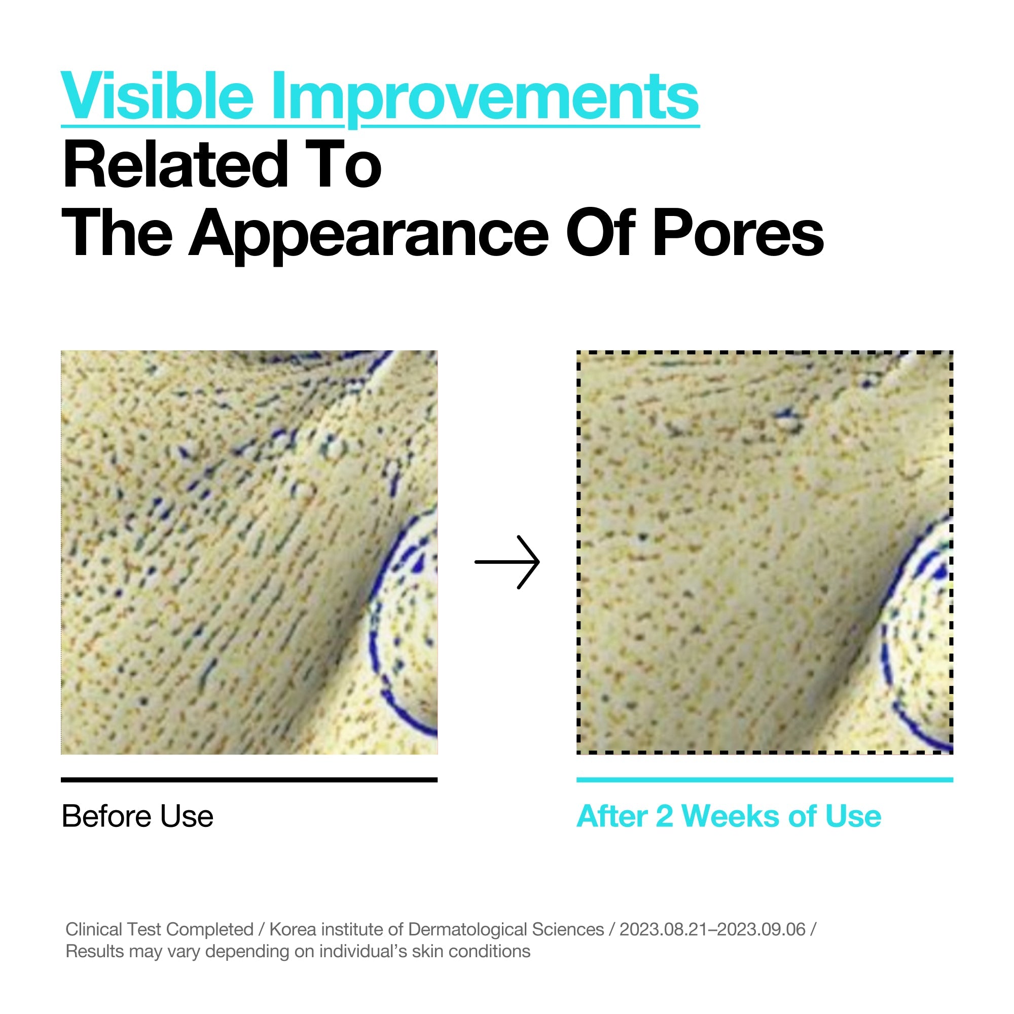 Fragrance-free, low-irritation formula for sensitive skin