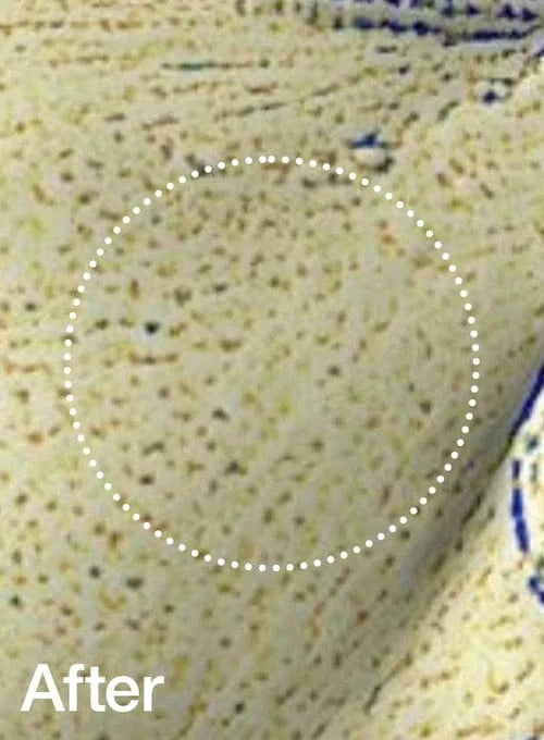 After: high satisfaction with pore care and skin clarity