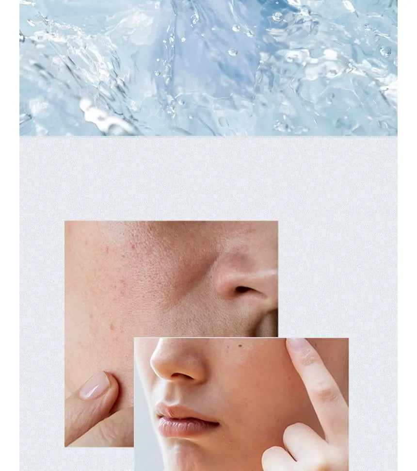 ANUA Birch Moisture Boosting Pad — dual-textured pad gently smooths and refreshes skin