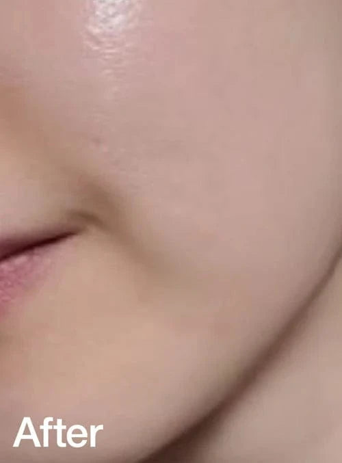 After 2 weeks: redness reduced by 4.89% in clinical testing