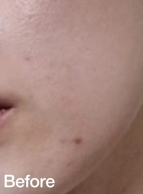 Before: redness caused by external irritation