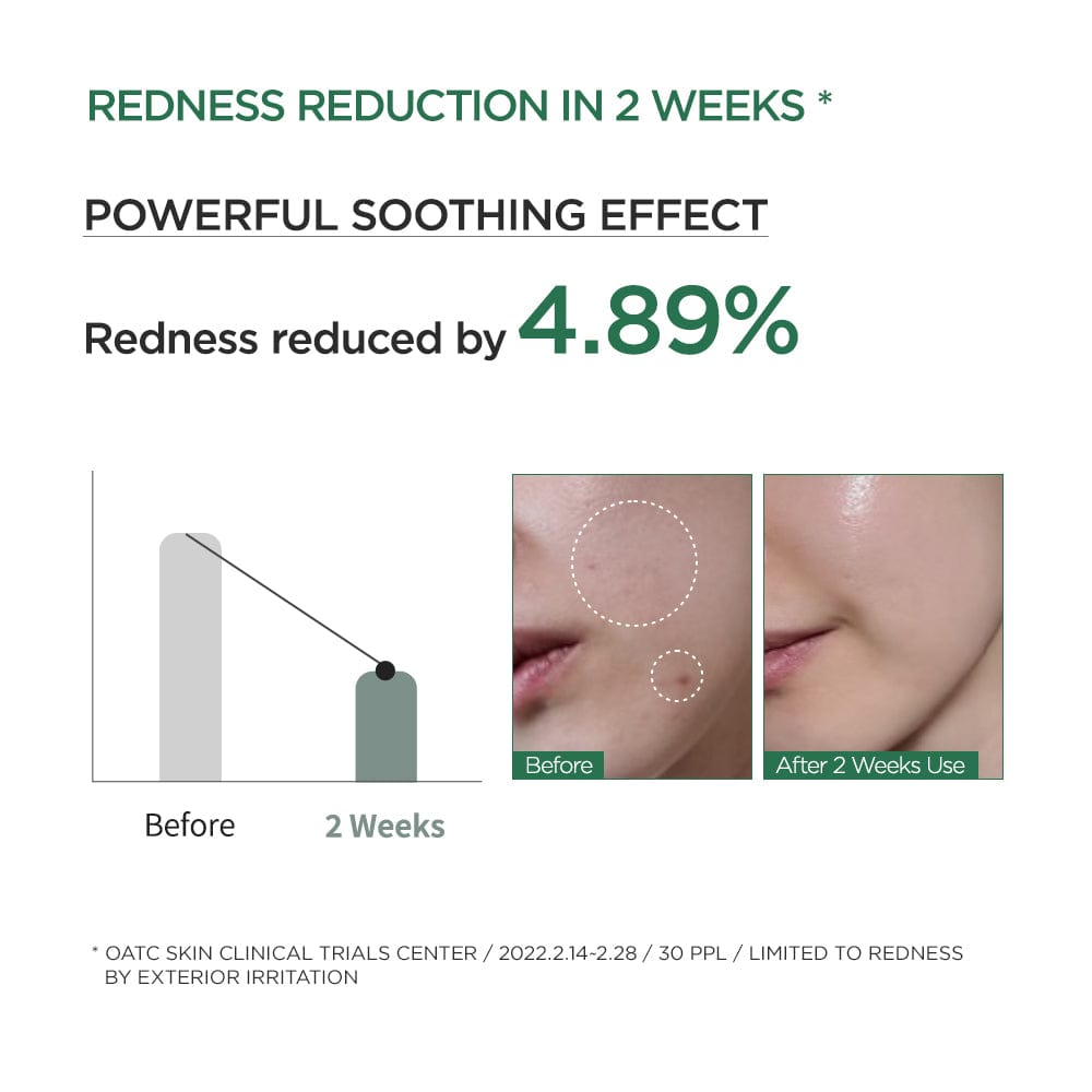 80% heartleaf extract calms redness and irritation
