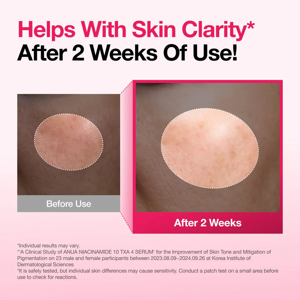 ANUA Niacinamide 10% + TXA 4% Serum — 10% niacinamide brightens for a clearer complexion