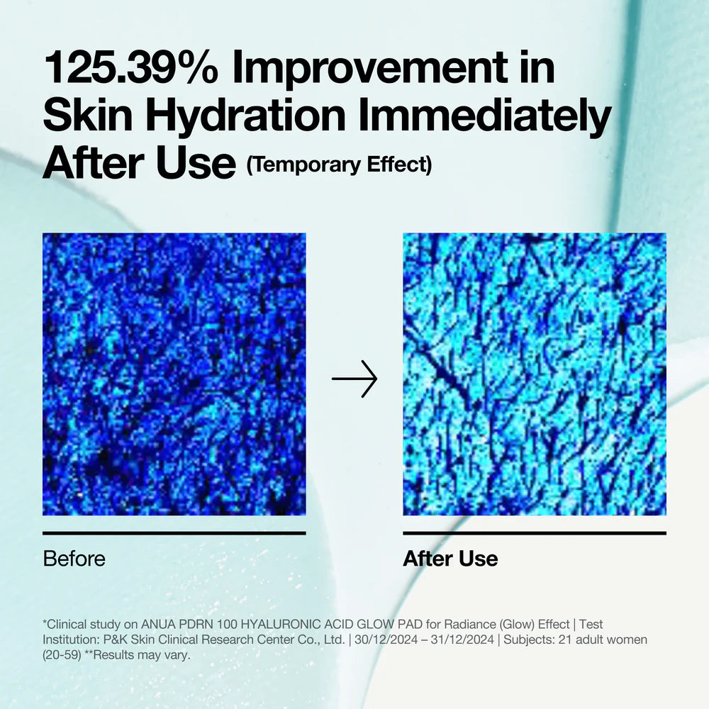 ANUA PDRN 100 Hyaluronic Acid Glow Pad — boosts radiance for a healthy, glassy glow