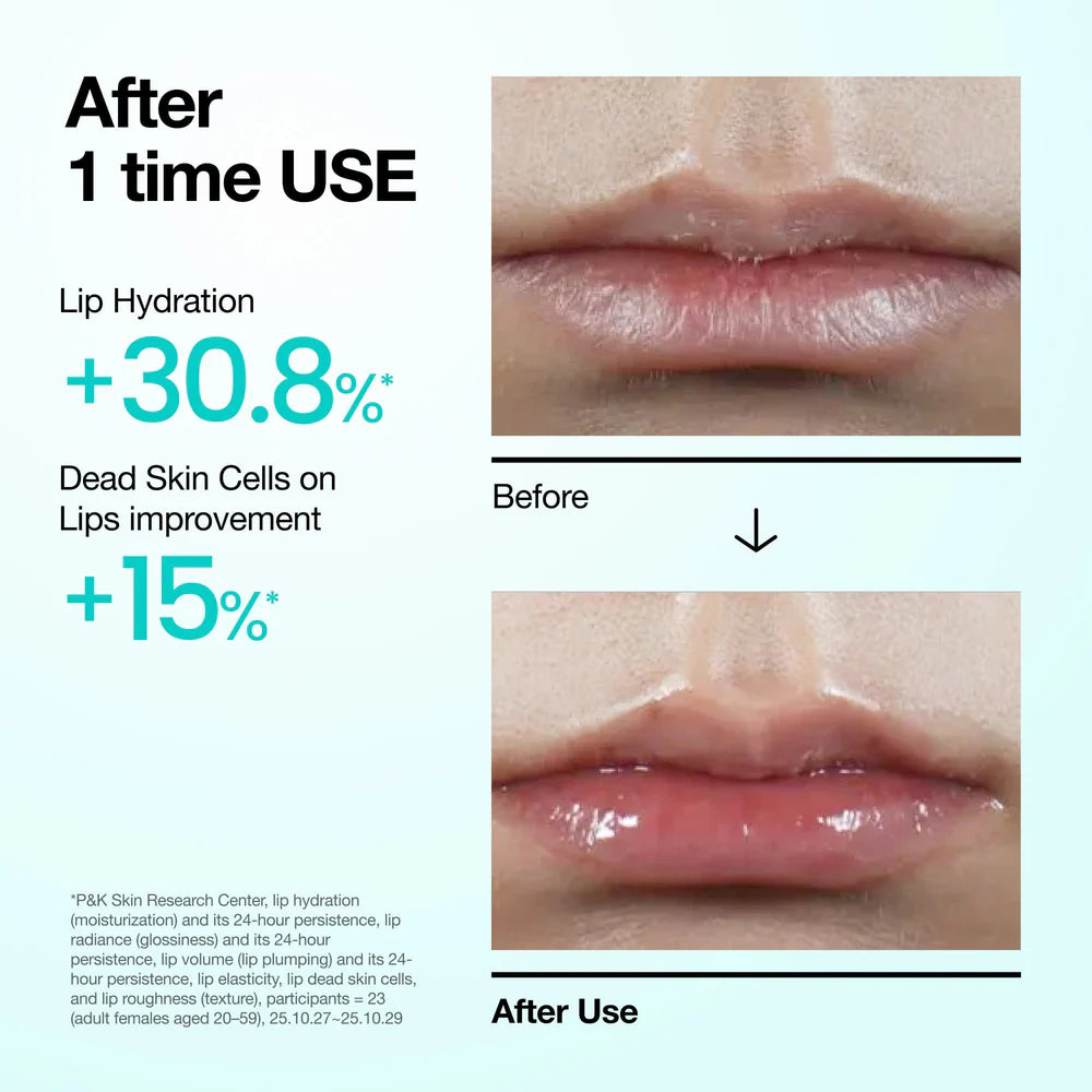 ANUA PDRN Hyaluron Lip Serum — plumps lips for a fuller, smoother look