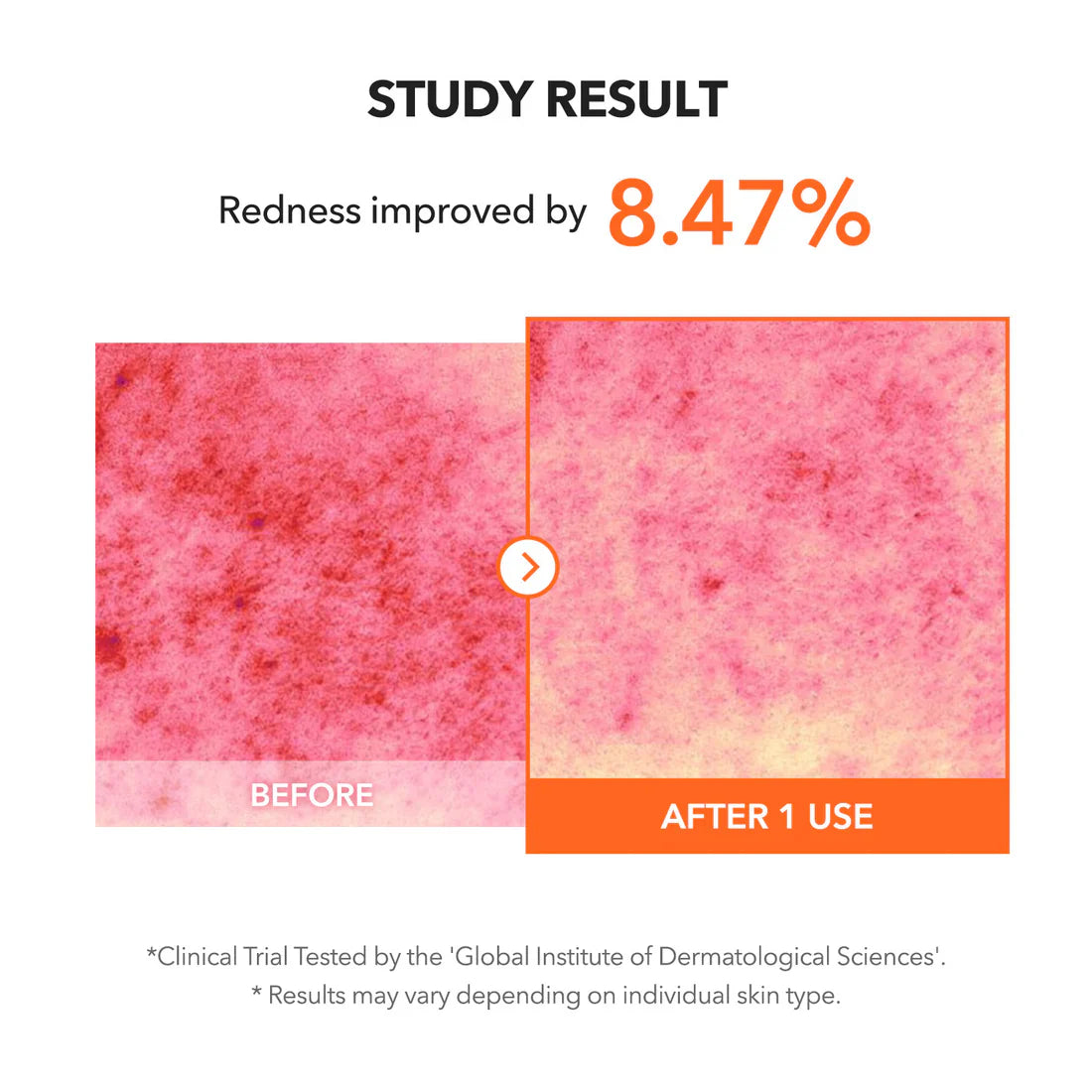 APRILSKIN Carrotene IPMP Clearing Solution carrotene for clearer skin