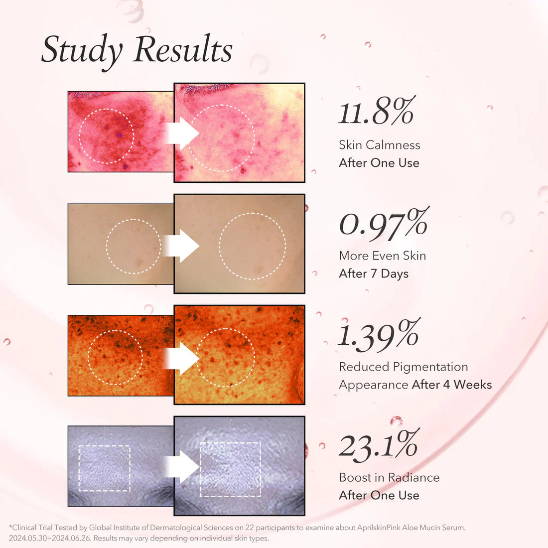 APRILSKIN Pink Aloe Mucin Serum gives a dewy healthy glow