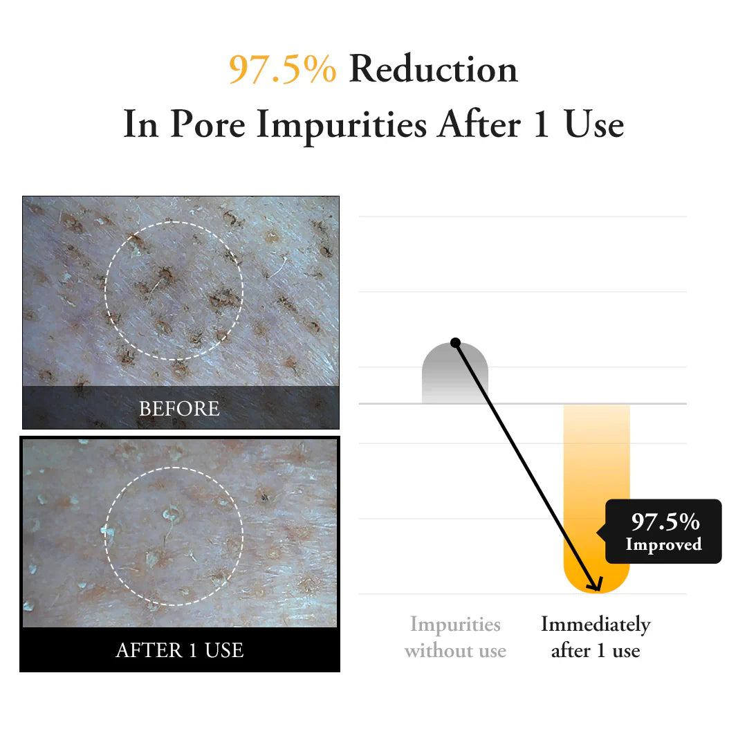 APRILSKIN Real Calendula Peel Off Pack calendula calms while it clarifies