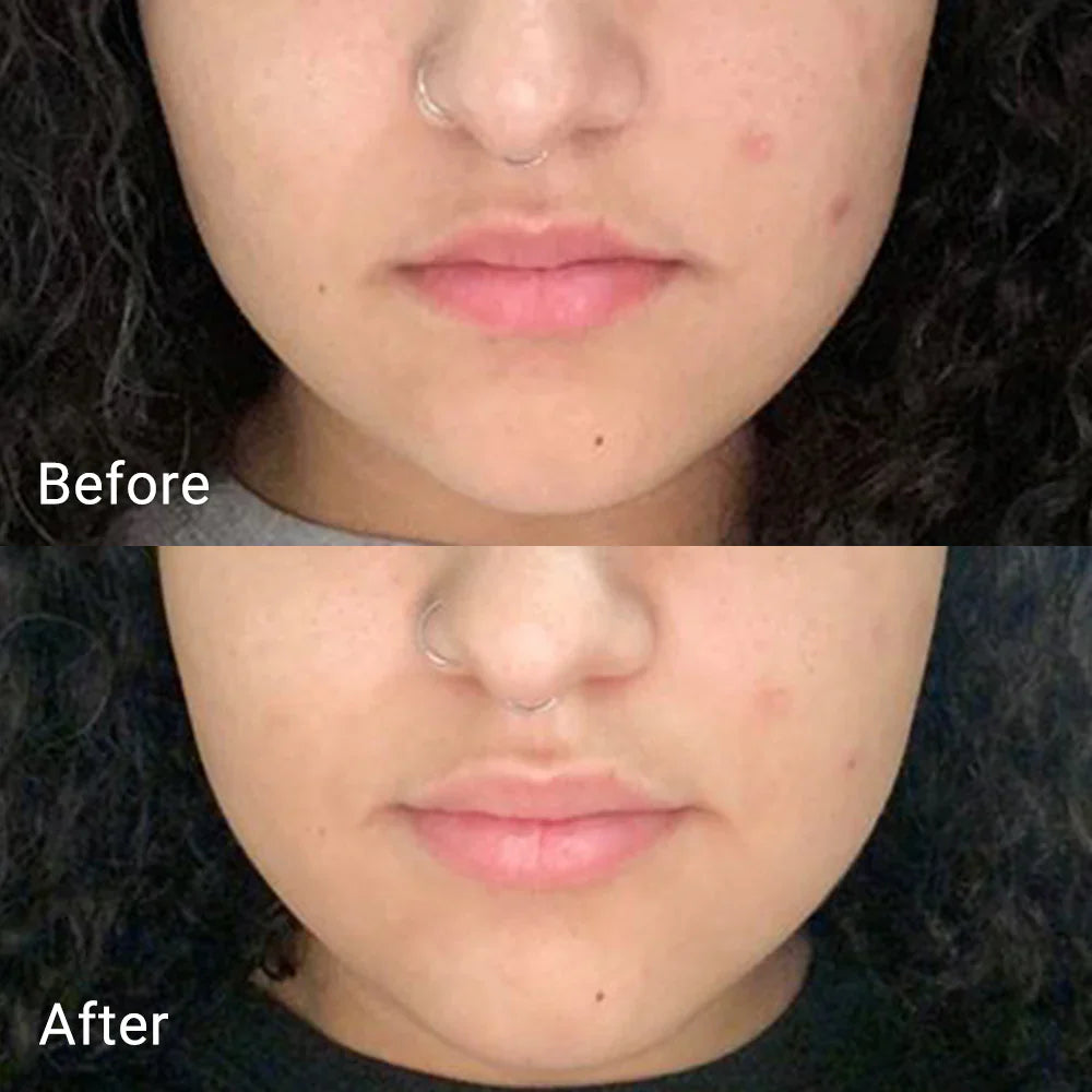 APRILSKIN Real Calendula Peel Off Pack — peel-off pack that purifies and soothes skin