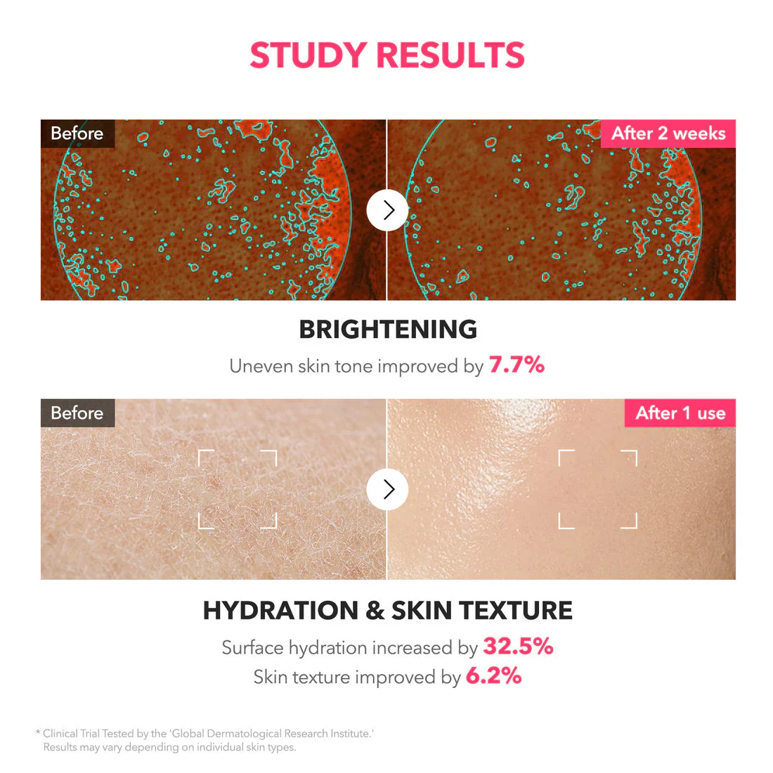 APRILSKIN TXA Niacinamide 99 Milky Toner soothes and softens skin