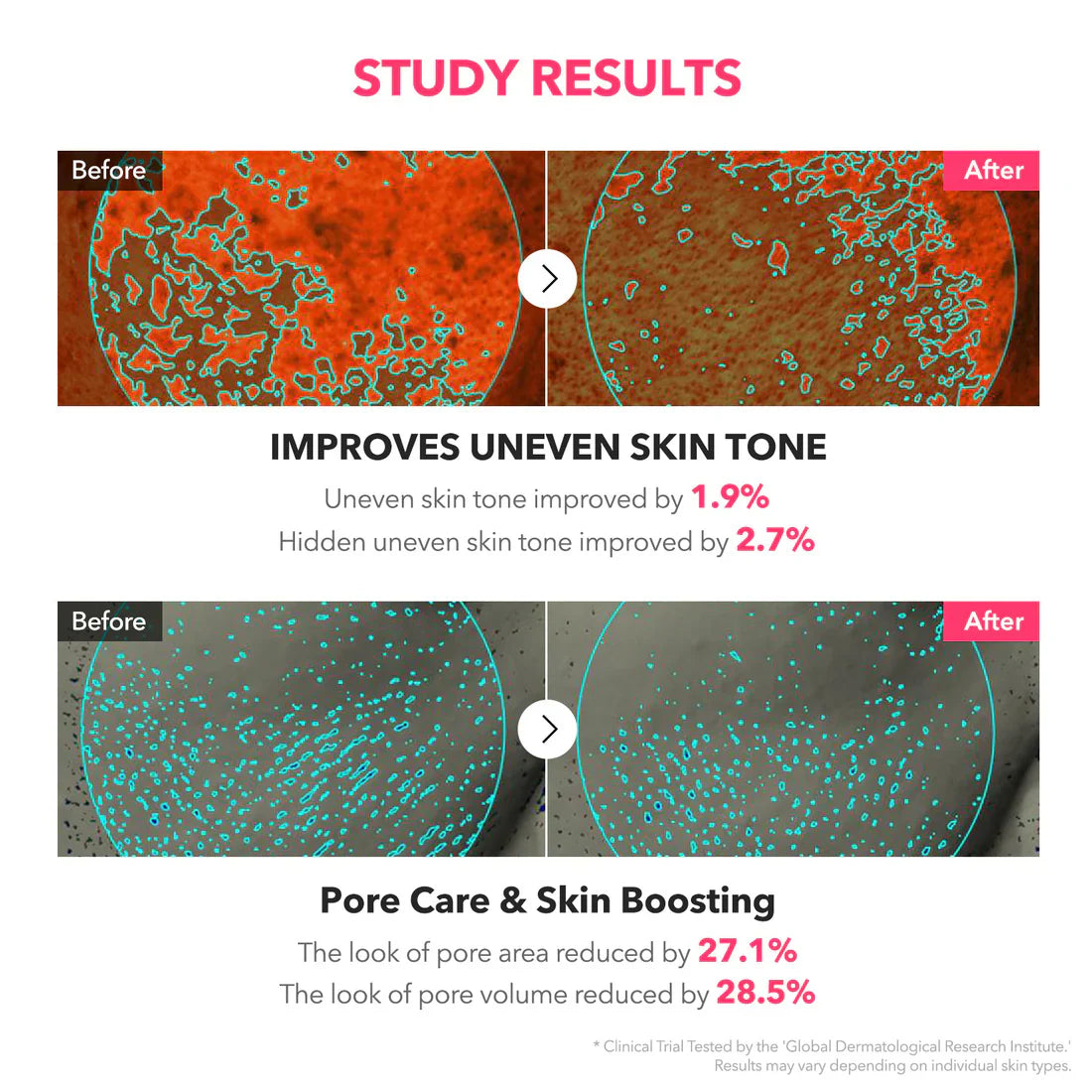 APRILSKIN TXA Niacinamide Toning Shot 99 Serum minimizes the look of pores
