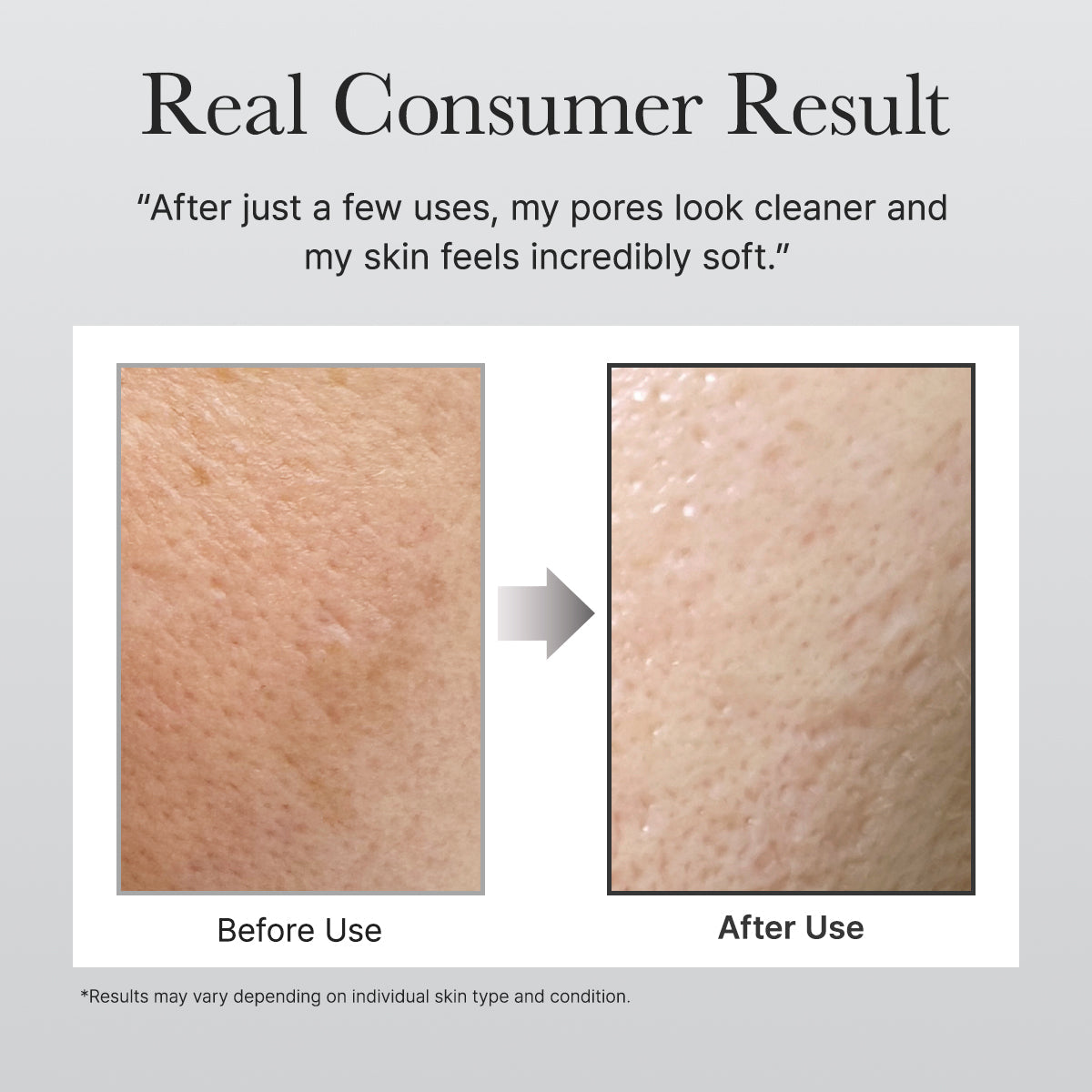 Gentle daily cleanse without over-drying