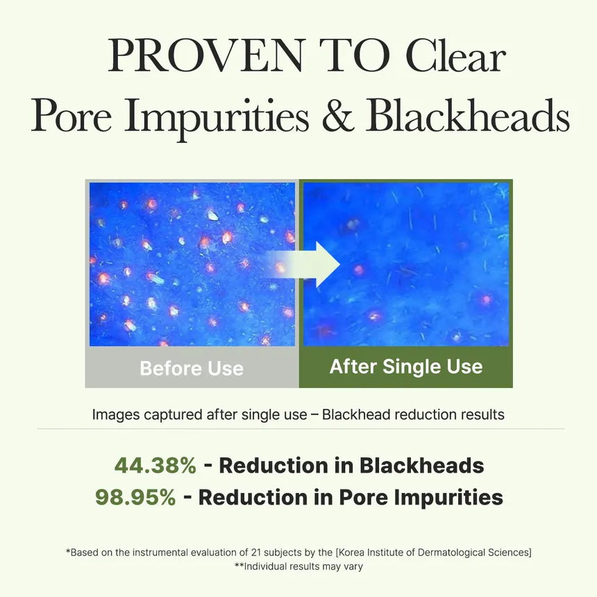 Deep pore purification, clinically tested