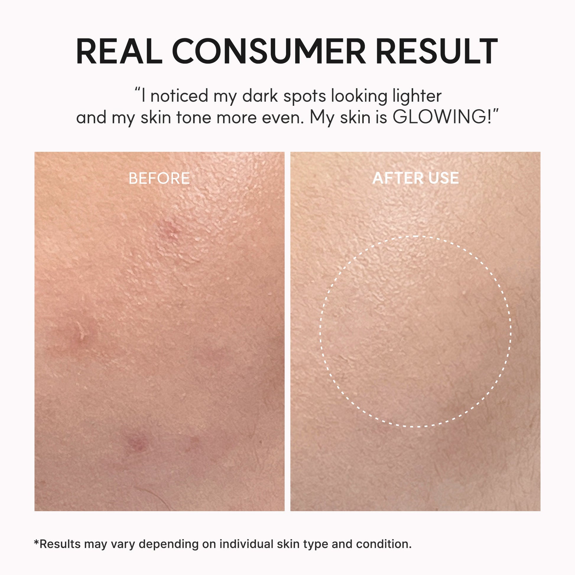 Lightweight serum for targeted spot care