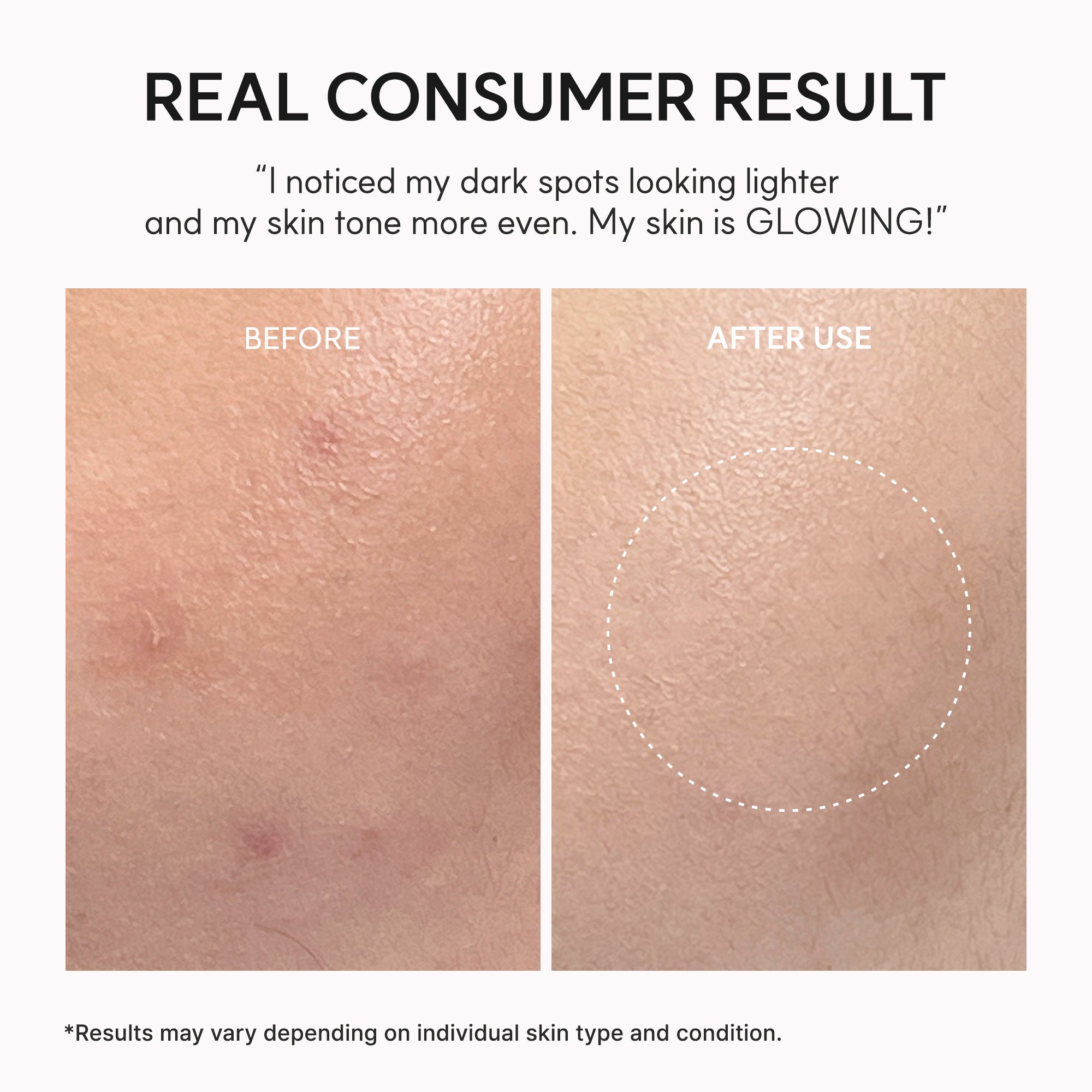 Lightweight serum for targeted spot care