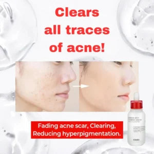 COSRX AC Collection Blemish Spot Clearing Serum