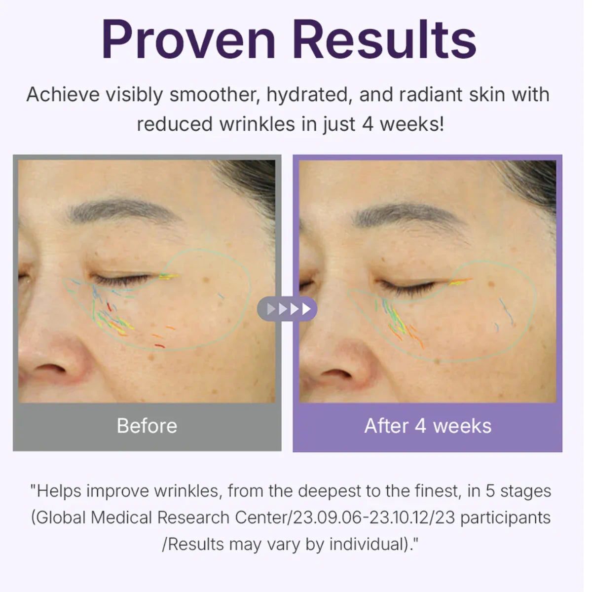 Apply Centellian 24 360 Shot PDRN Active Serum after toner, morning and night
