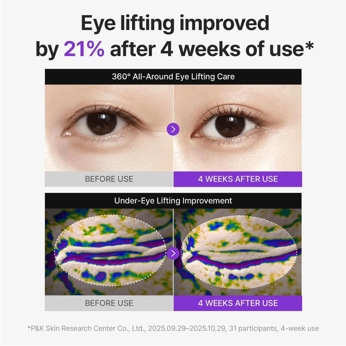 Centellian 24 360 Shot PDRN Firming Eye Cream targets fine lines, puffiness and dark circles