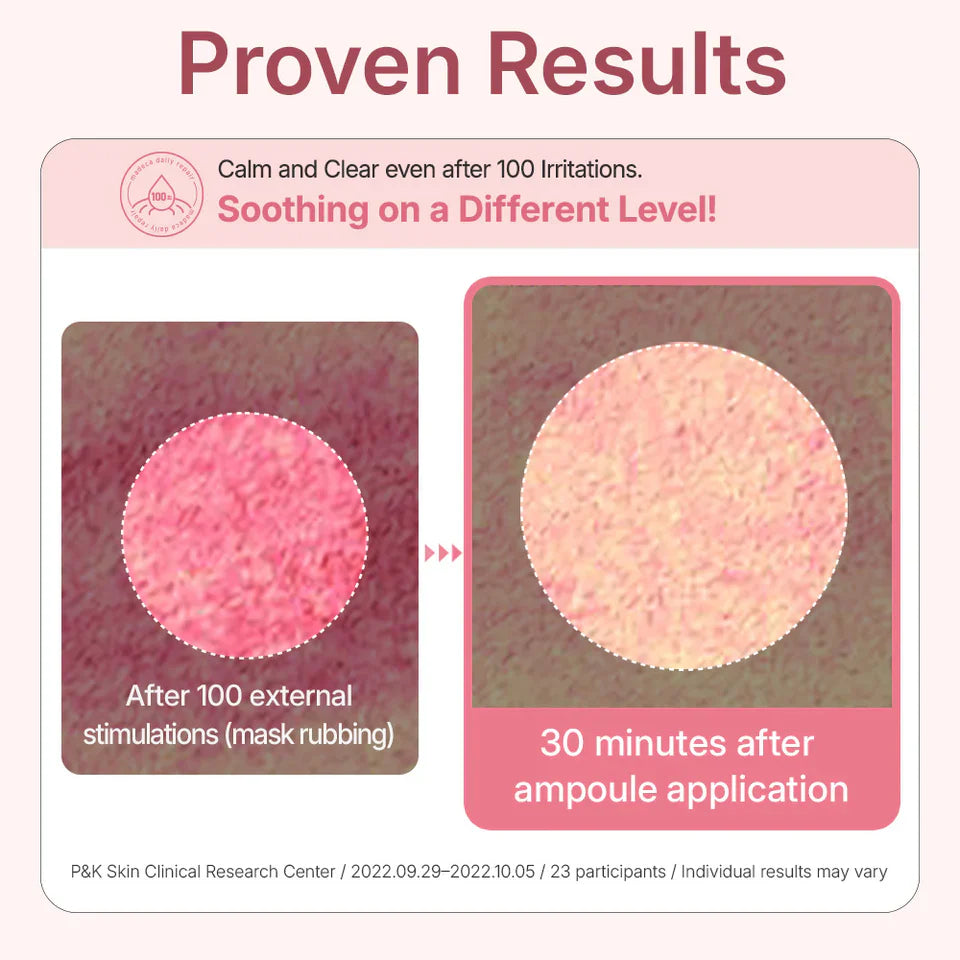 Apply Centellian 24 Madeca Daily Repair Ampoule after toner to soothe and strengthen skin