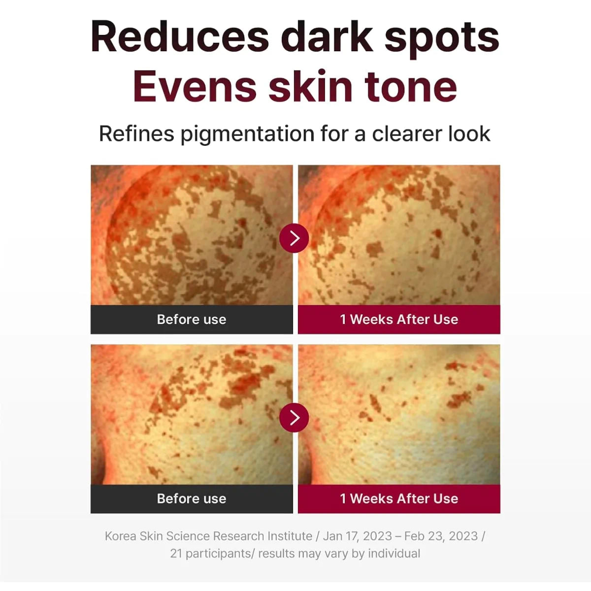 Wipe a Centellian 24 Madeca Mela Capture Ampoule Pad over cleansed skin to brighten and smooth