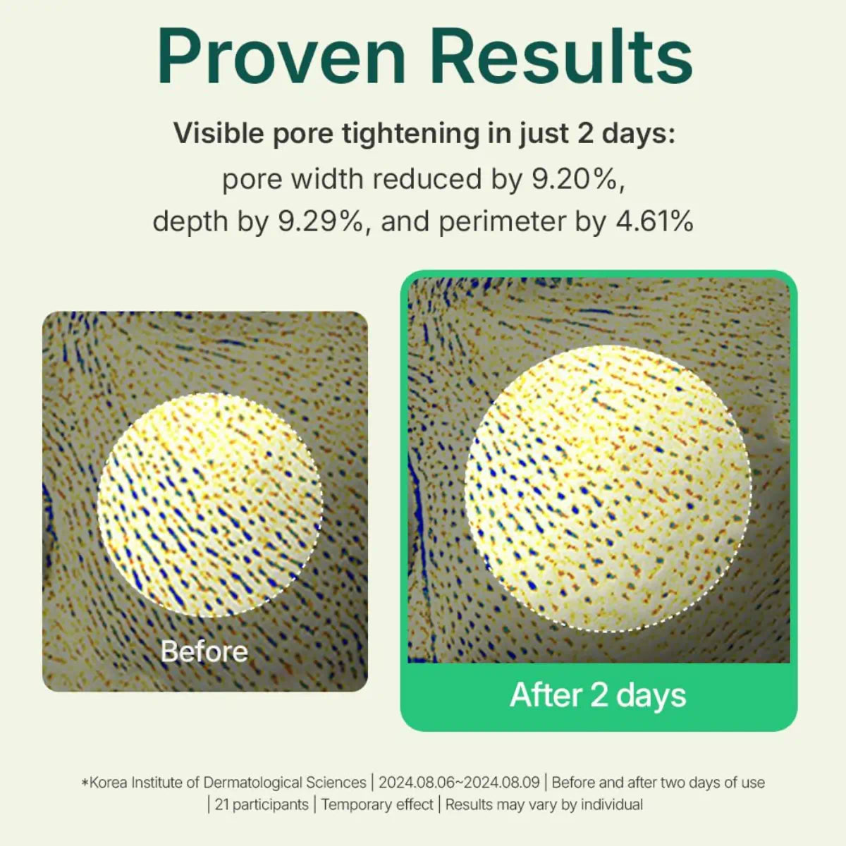 Centellian 24 Madeca Powder Teatree AC 6g – targeted spot powder that calms breakouts and absorbs excess oil
