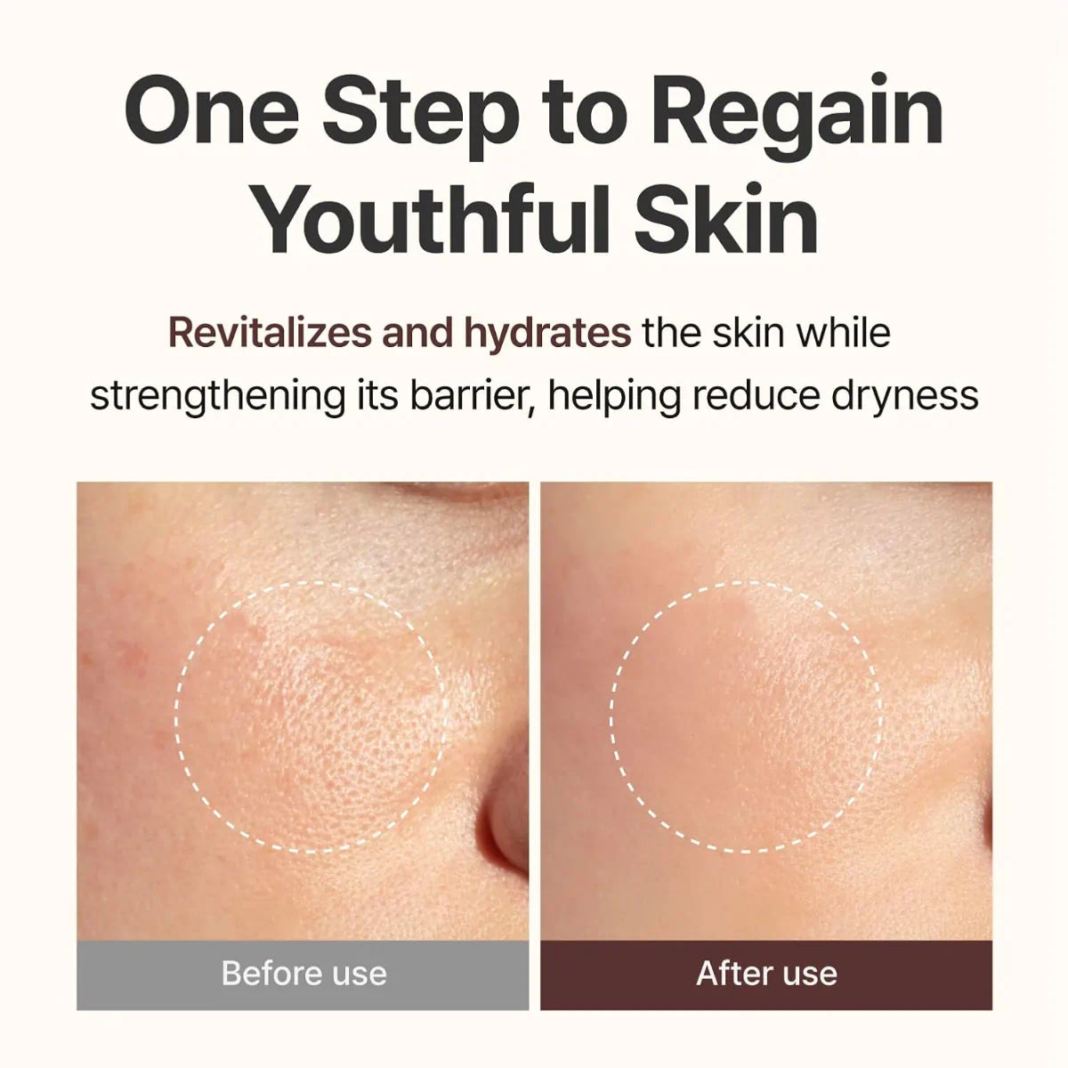 Centellian 24 PDRN Firming Boosting Ampoule improves elasticity and softens the look of fine lines