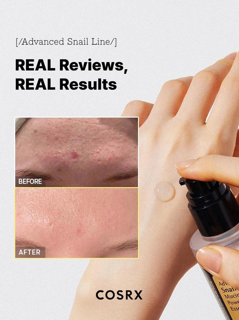 COSRX Advanced Snail 96 Mucin Power Essence — improves the look of skin elasticity