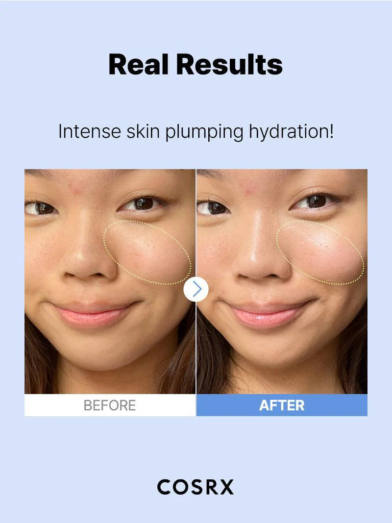 COSRX The Hyaluronic Acid 3 Serum — lightweight serum absorbs quickly