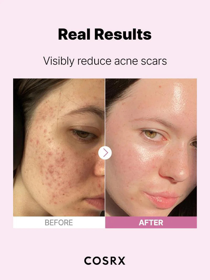COSRX The Niacinamide 15 Serum — lightweight serum absorbs without stickiness