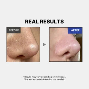 Medicube One Day Exosome Shot Pore Ampoule 2000