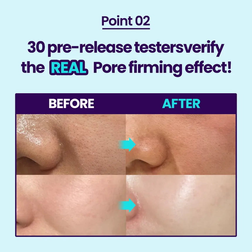 Dr.G RED Blemish Bakuchiol Pore-Jet Cream soothes blemish-prone skin